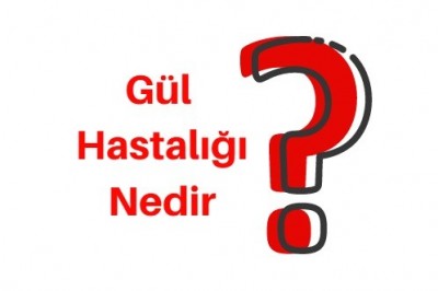 Gül Hastalığı (Rozasea) Evreleri Belirtileri ve Tedavisi