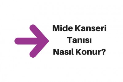 Mide Kanseri Belirtileri Nelerdir? Mide Kanserinin Evreleri ve Türleri