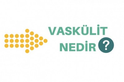 Vaskülit (Damar İltihabı)  Nedir Neden Olur? Vaskülitin Belirtileri ve Türleri