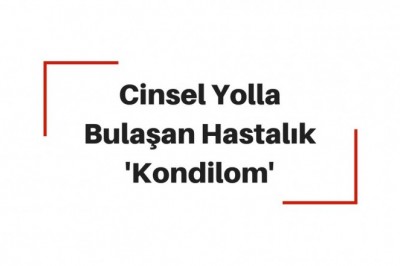 Kondilom (Genital Siğil) Nedir Belirtileri Neler? Tedavi Yöntemleri