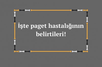 Paget hastalığı (osteitis deformans) nedir nedenleri nelerdir? Paget hastalığı teşhisi ve tedavisi